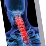 Chiropractor in Rochester NY | Rochester NY Chiropractor