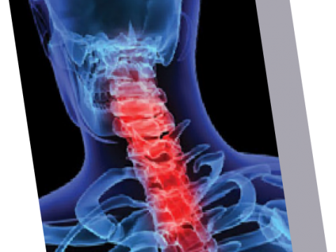 Upper Cervical Chiropractor in Rochester NY | Rochester NY Chiropractor