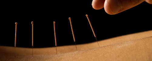 Acupuncture in Rochester NY