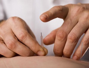 Acupuncture Rochester NY