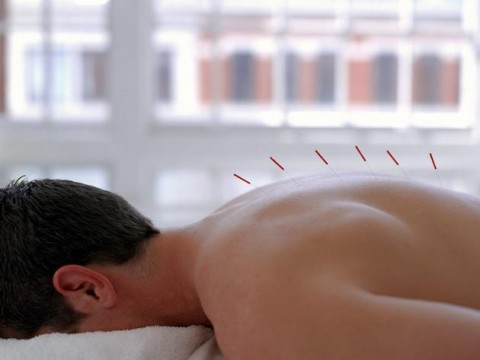 acupuncture reduce stress Acupuncture Rochester NY