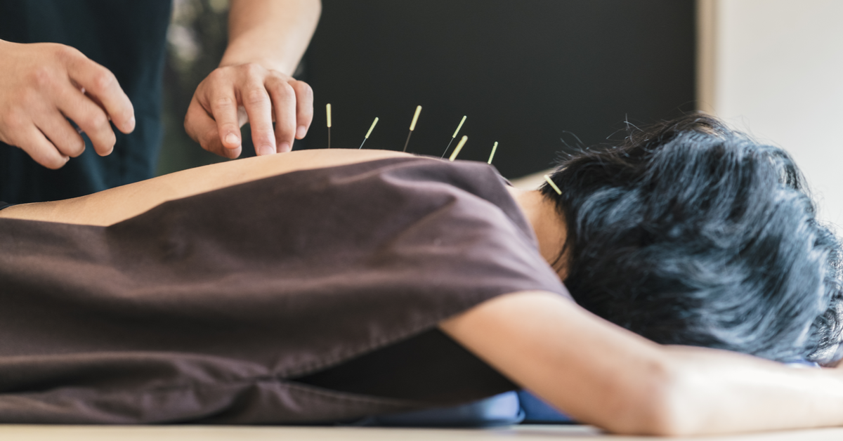 Treat Chronic Paid With Acupuncture